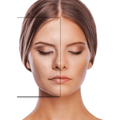 Anti-Aging Treatments in Dubai