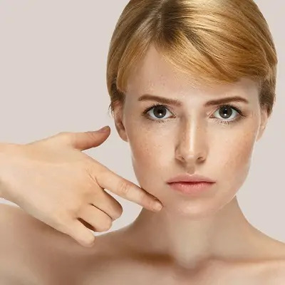 Buccal Fat Removal in Dubai & Abu Dhabi