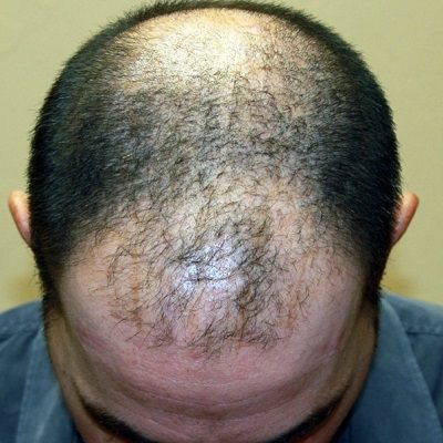 G Cell Treatment in Dubai