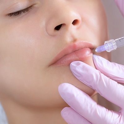 Lip Fillers Injections in Dubai