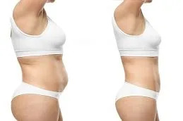 Mounjaro Injection Before & after 