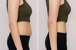 Mounjaro Injection in Dubai & Abu Dhabi