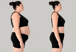 Mounjaro Injection Before & after