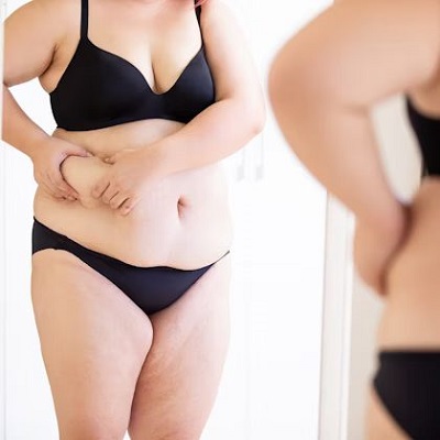 Tummy Tuck in Dubai