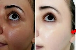Best Skin Whitening Treatment in Dubai