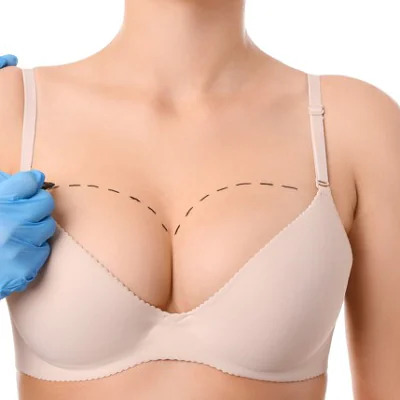 Breast augmentation in Dubai