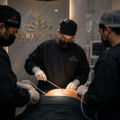 Liposuction Surgery performed in Glam clinic dubai