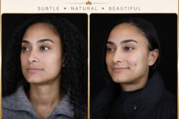 Before and after results in Dubai Abu Dhabi